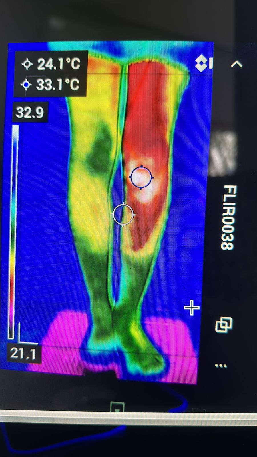 Procedimentos guiados por Ultrassom e Termografia Digital