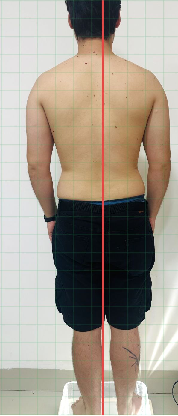 Avaliação postural e biomecânica